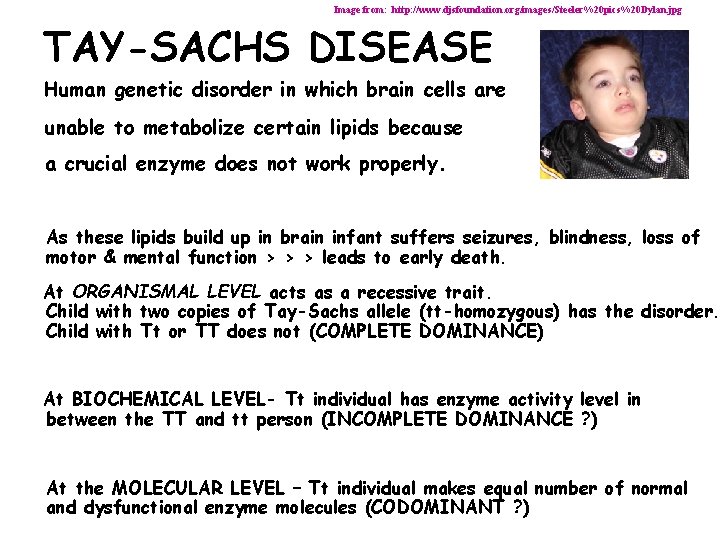 Image from: http: //www. djsfoundation. org/images/Steeler%20 pics%20 Dylan. jpg TAY-SACHS DISEASE Human genetic disorder