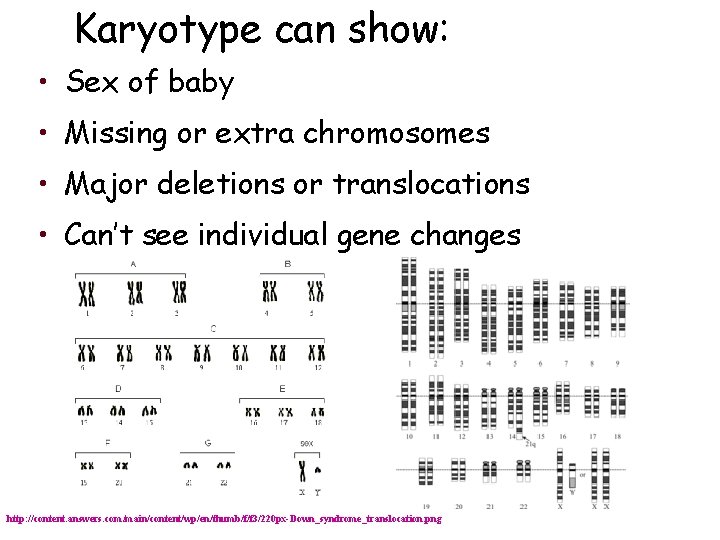 Karyotype can show: • Sex of baby • Missing or extra chromosomes • Major