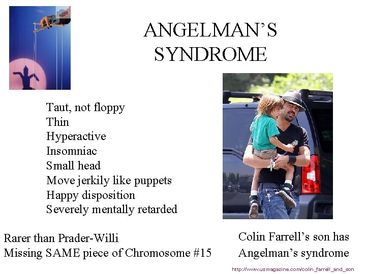 ANGELMAN’S SYNDROME Taut, not floppy Thin Hyperactive Insomniac Small head Move jerkily like puppets