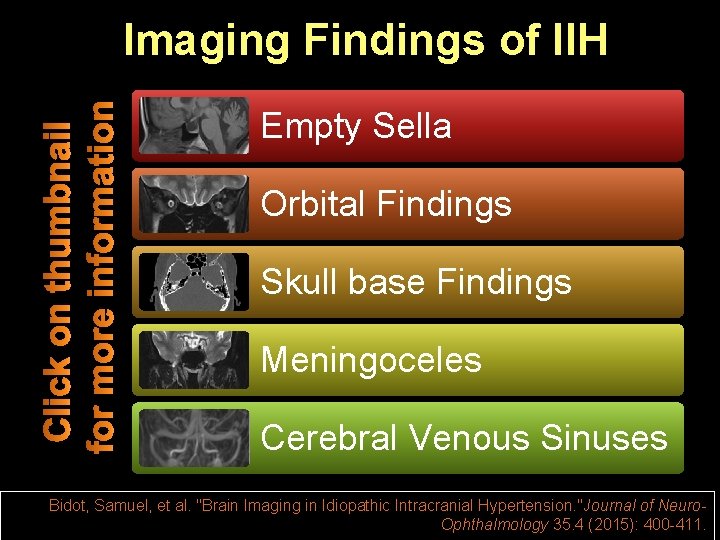 Imaging Findings of IIH Empty Sella Orbital Findings Skull base Findings Meningoceles Cerebral Venous