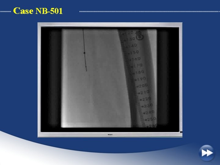 Case NB-501 
