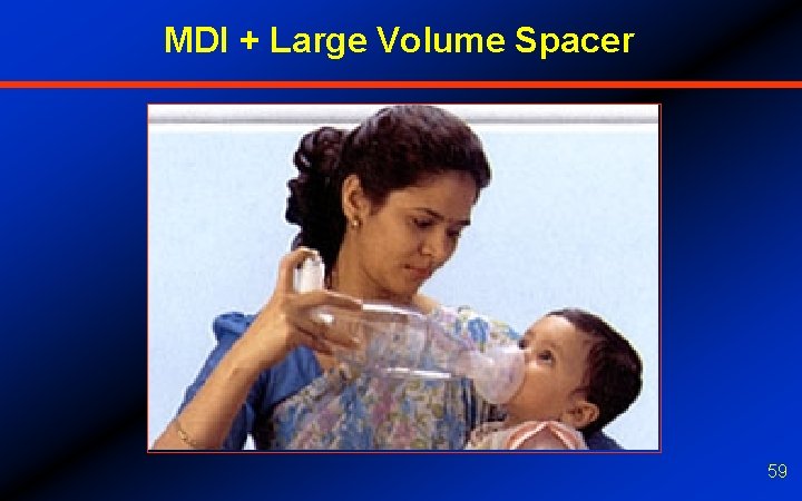 MDI + Large Volume Spacer 59 