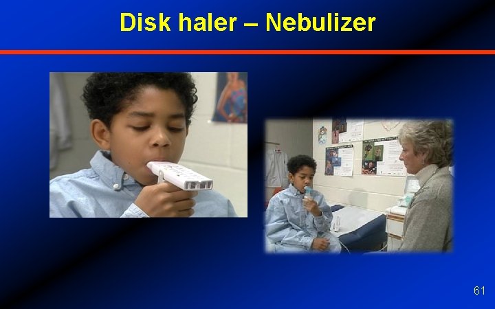 Disk haler – Nebulizer 61 