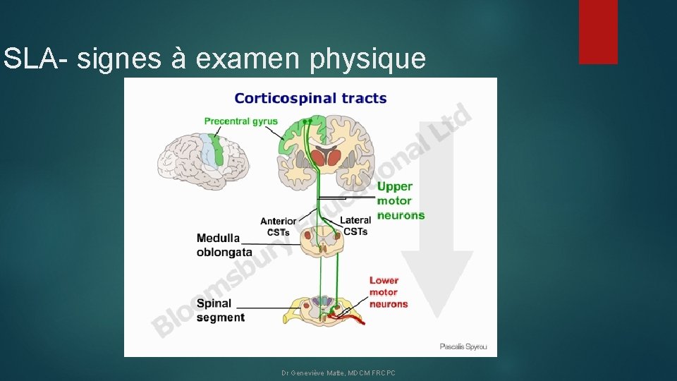 SLA- signes à examen physique Dr Geneviève Matte, MDCM FRCPC 