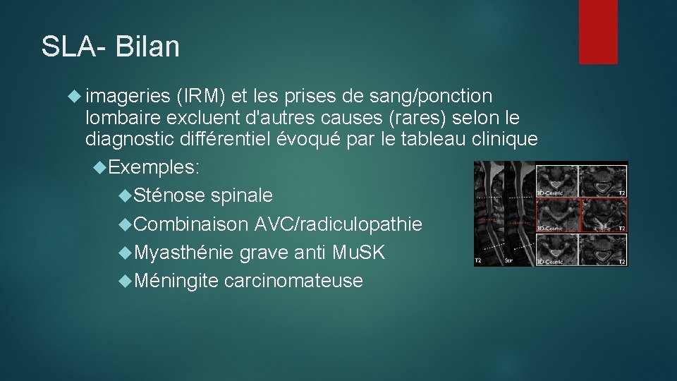 SLA- Bilan imageries (IRM) et les prises de sang/ponction lombaire excluent d'autres causes (rares)