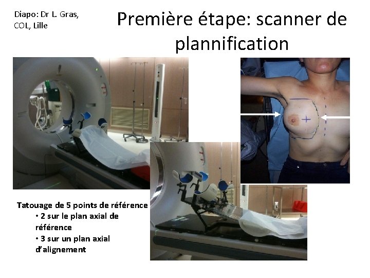 Diapo: Dr L. Gras, COL, Lille Première étape: scanner de plannification Tatouage de 5