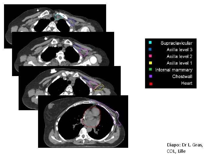 Diapo: Dr L. Gras, COL, Lille 