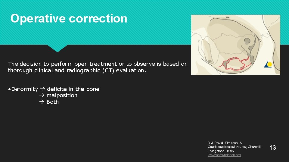 Operative correction The decision to perform open treatment or to observe is based on