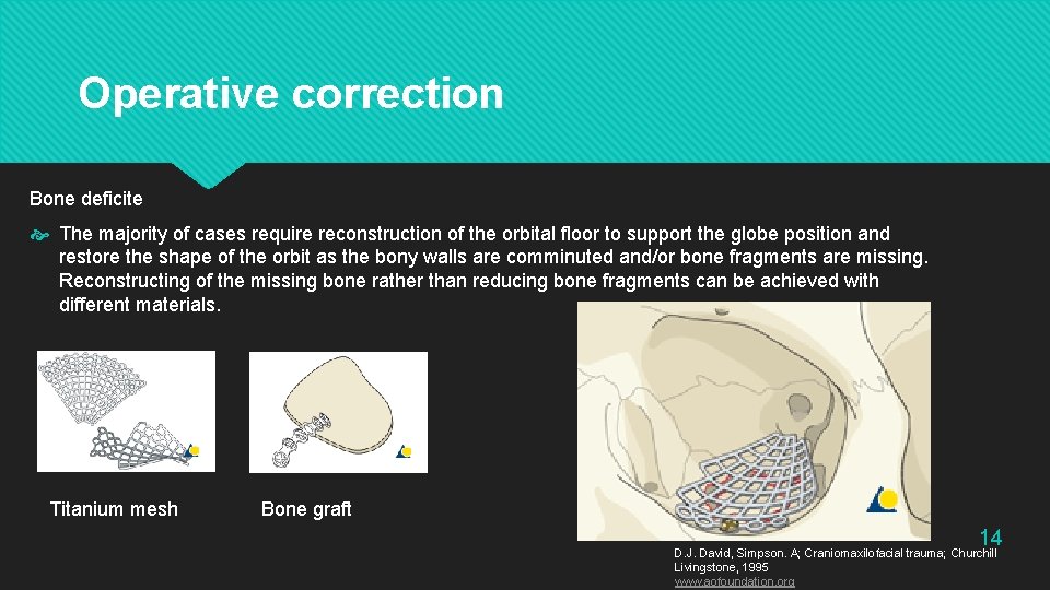  Operative correction Bone deficite The majority of cases require reconstruction of the orbital