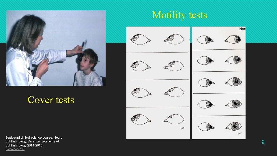 Motility tests Cover tests Basic and clinical science course, Neuro ophthalmology; American academy of