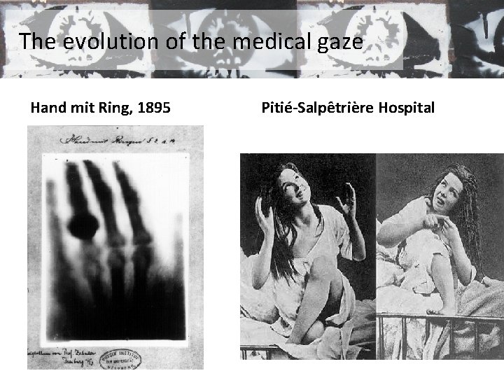 The evolution of the medical gaze Hand mit Ring, 1895 Pitié-Salpêtrière Hospital 