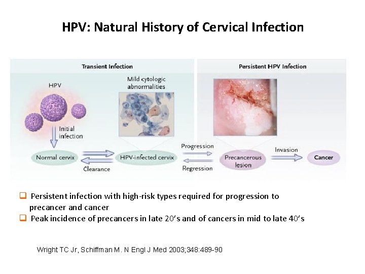 HPV: Natural History of Cervical Infection q Persistent infection with high-risk types required for