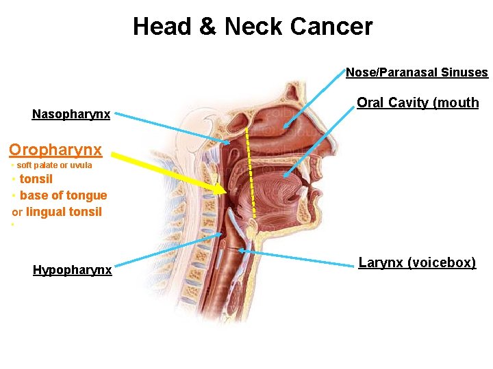 Head & Neck Cancer Nose/Paranasal Sinuses Nasopharynx Oral Cavity (mouth) Oropharynx • soft palate