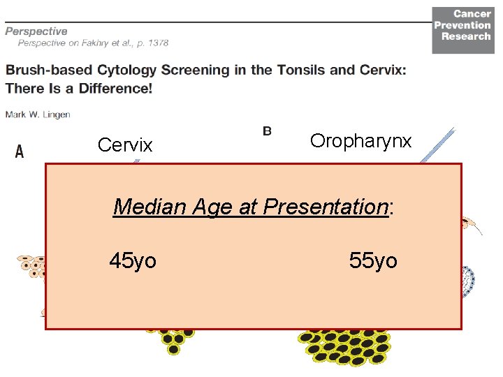 Cervix Oropharynx Median Age at Presentation: 45 yo 55 yo 