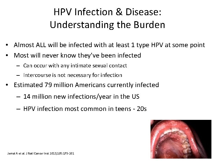 HPV Infection & Disease: Understanding the Burden • Almost ALL will be infected with
