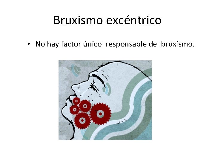 Bruxismo excéntrico • No hay factor único responsable del bruxismo. 