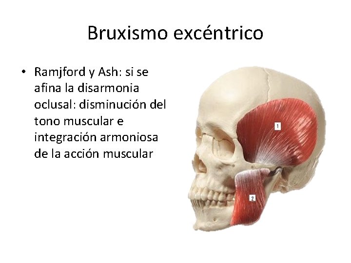 Bruxismo excéntrico • Ramjford y Ash: si se afina la disarmonia oclusal: disminución del