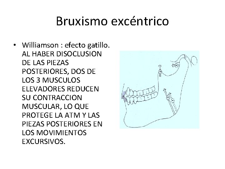 Bruxismo excéntrico • Williamson : efecto gatillo. AL HABER DISOCLUSION DE LAS PIEZAS POSTERIORES,