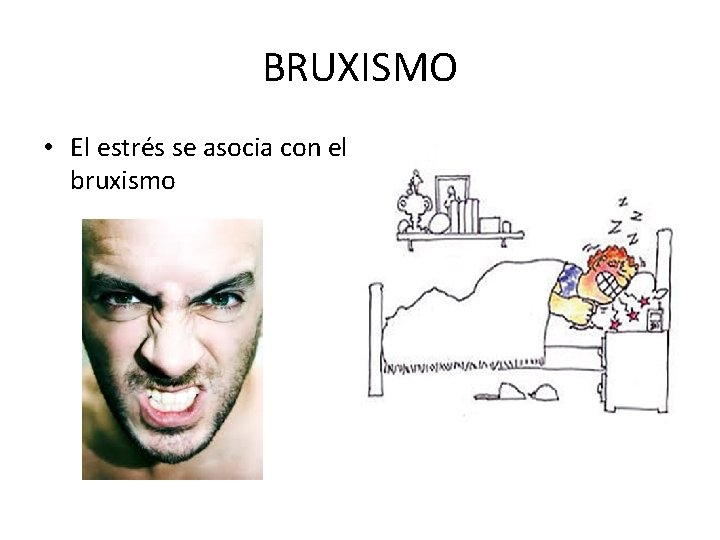 BRUXISMO • El estrés se asocia con el bruxismo 