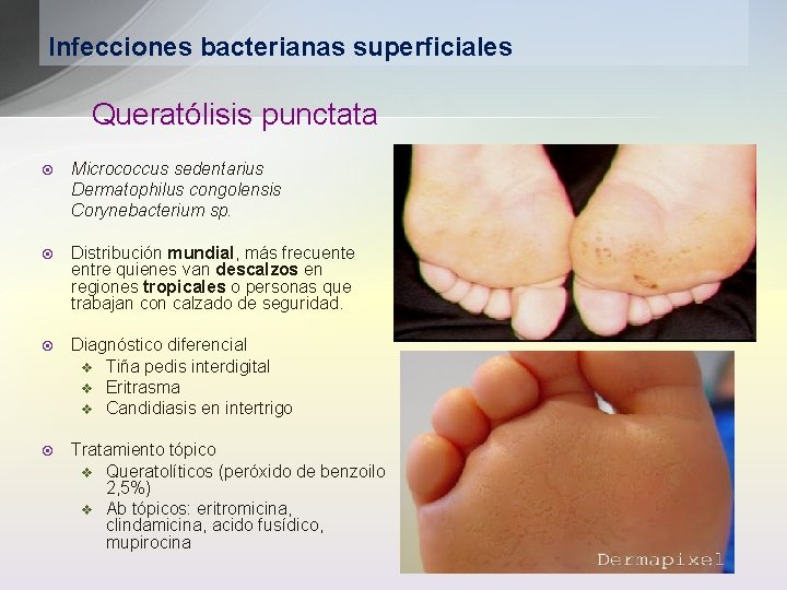 Infecciones bacterianas superficiales Queratólisis punctata ¤ Micrococcus sedentarius Dermatophilus congolensis Corynebacterium sp. ¤ Distribución