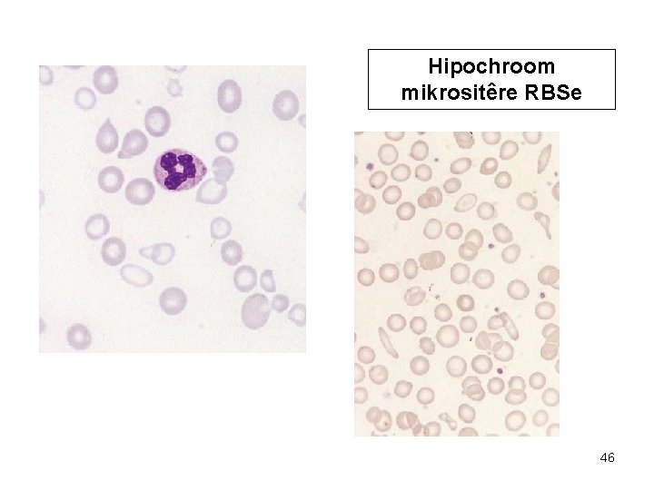 Hipochroom mikrositêre RBSe 46 