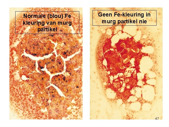 Normale (blou) Fe kleuring van murg partikel Geen Fe-kleuring in murg partikel nie 47