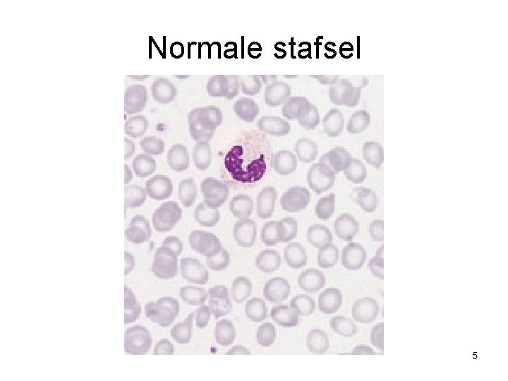 Normale stafsel 5 