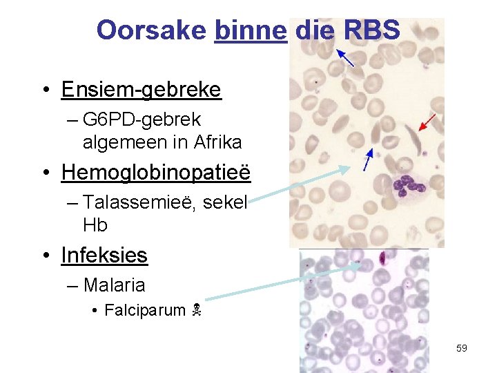 Oorsake binne die RBS • Ensiem-gebreke – G 6 PD-gebrek algemeen in Afrika •