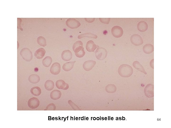 Beskryf hierdie rooiselle asb. 64 