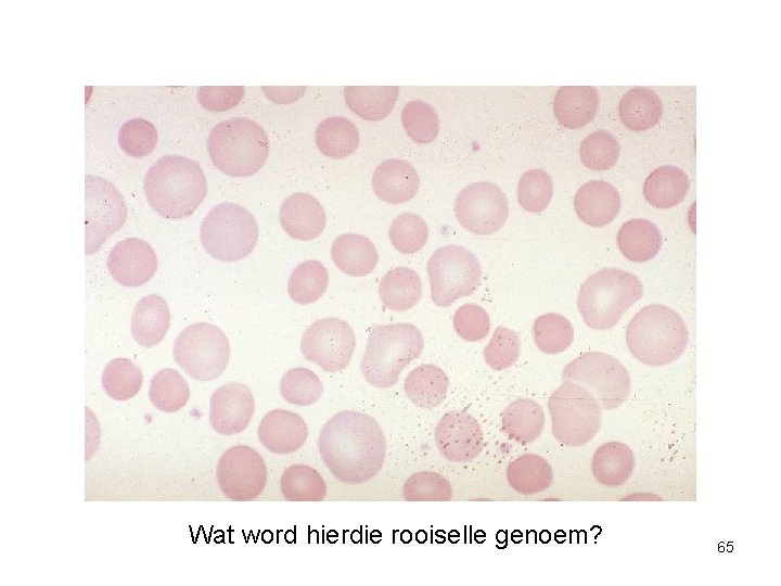 Wat word hierdie rooiselle genoem? 65 