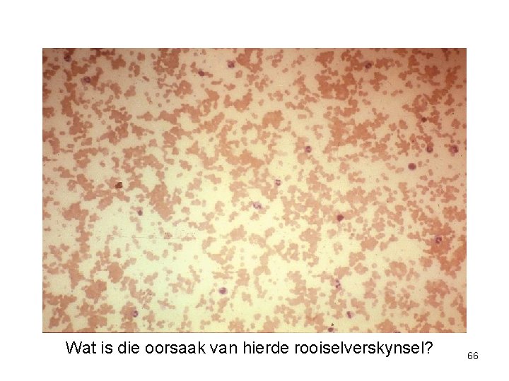 Wat is die oorsaak van hierde rooiselverskynsel? 66 