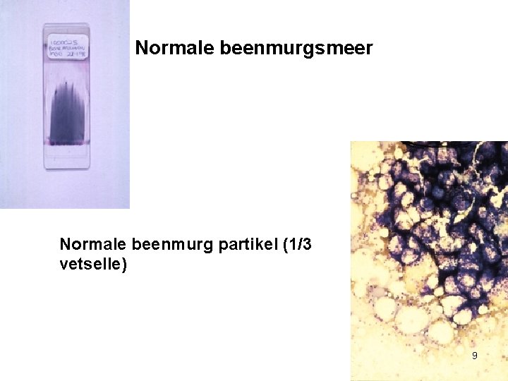 Normale beenmurgsmeer Normale beenmurg partikel (1/3 vetselle) 9 