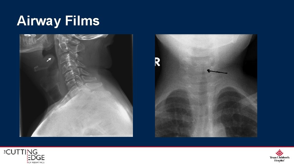 Airway Films Airway Films