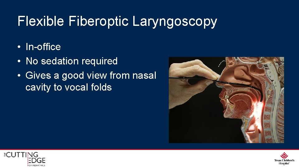 Flexible Fiberoptic Laryngoscopy • In-office • No sedation required • Gives a good view Flexible Fiberoptic Laryngoscopy • In-office • No sedation required • Gives a good view