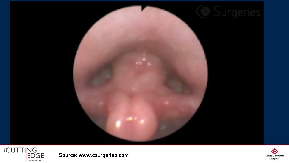 Source: www. csurgeries. com 