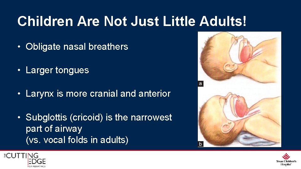 Children Are Not Just Little Adults! • Obligate nasal breathers • Larger tongues •