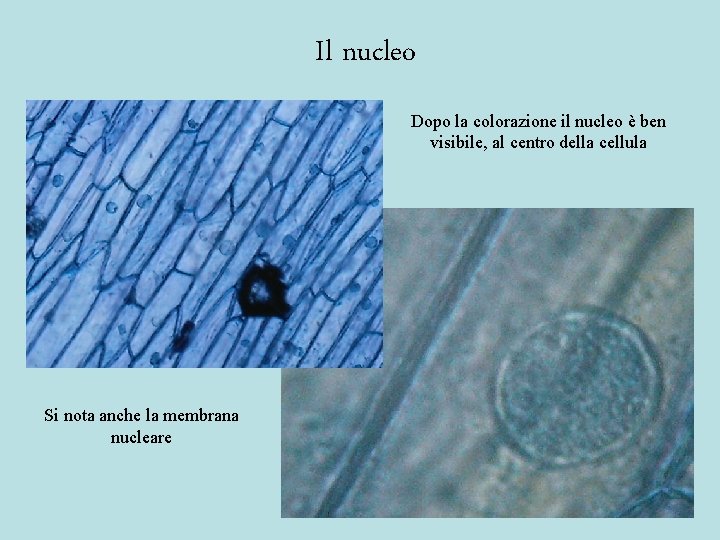 Il nucleo Dopo la colorazione il nucleo è ben visibile, al centro della cellula