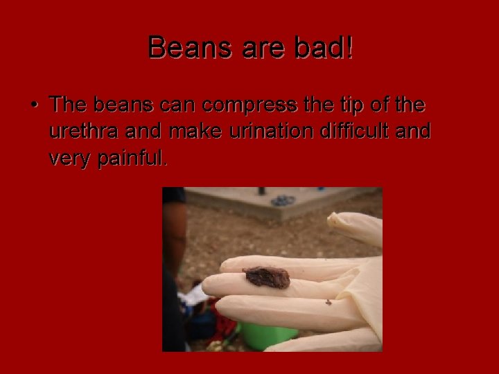 Beans are bad! • The beans can compress the tip of the urethra and Beans are bad! • The beans can compress the tip of the urethra and