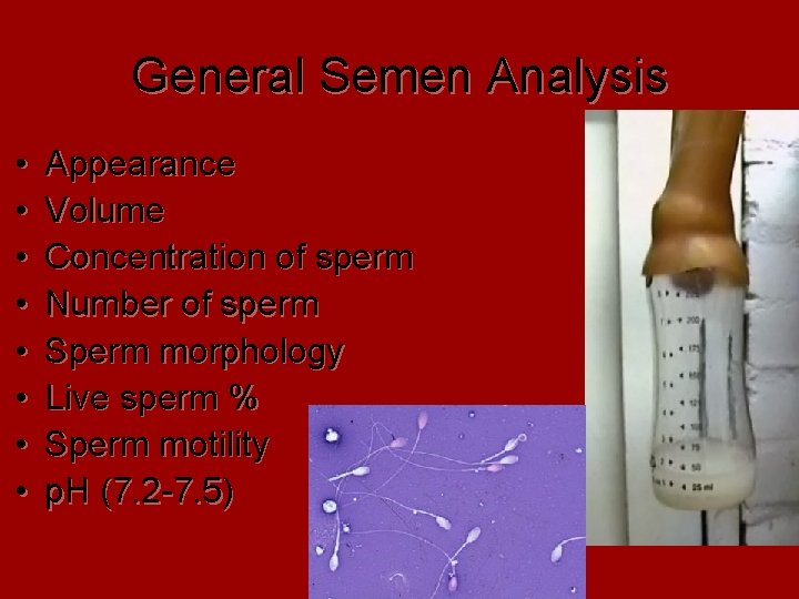 General Semen Analysis • • Appearance Volume Concentration of sperm Number of sperm Sperm