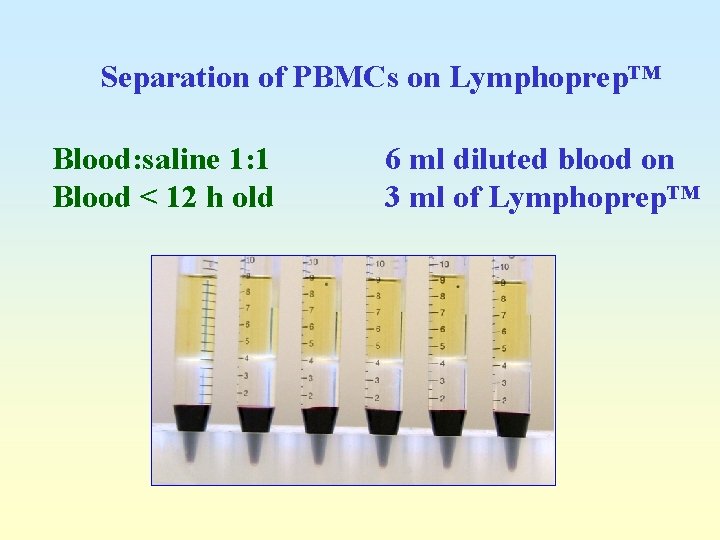 Separation of PBMCs on Lymphoprep™ Blood: saline 1: 1 Blood < 12 h old