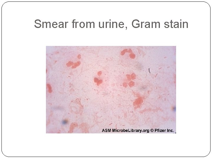 Smear from urine, Gram stain 