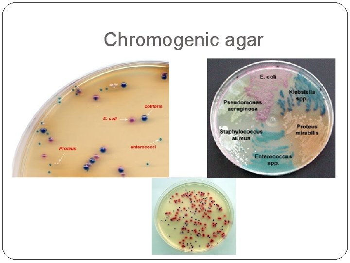 Chromogenic agar 