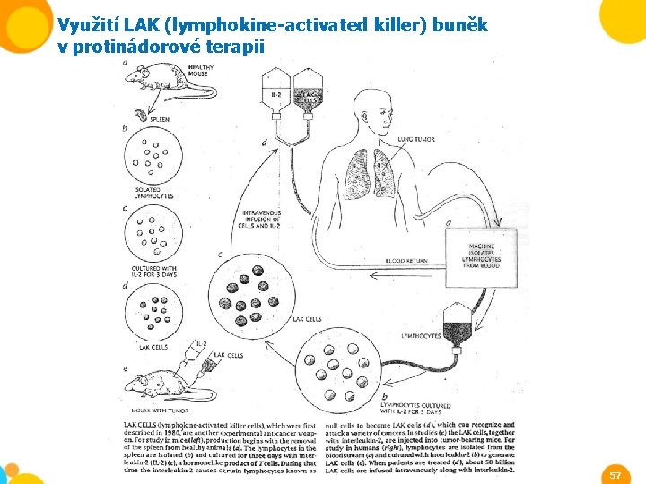 Využití LAK (lymphokine-activated killer) buněk v protinádorové terapii 57 