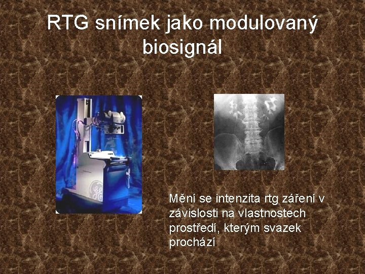 RTG snímek jako modulovaný biosignál Mění se intenzita rtg záření v závislosti na vlastnostech