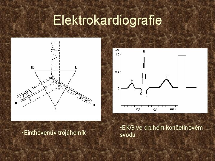 Elektrokardiografie • Einthovenův trojúhelník • EKG ve druhém končetinovém svodu 