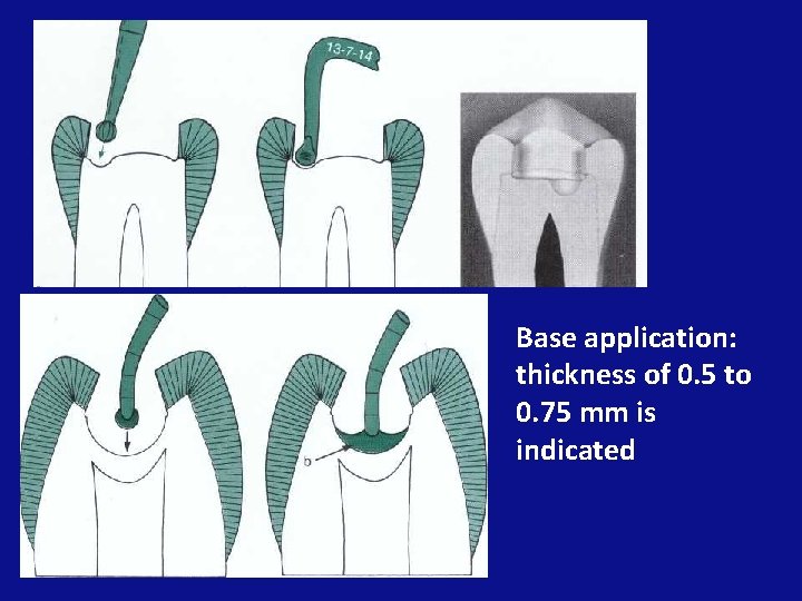 Base application: thickness of 0. 5 to 0. 75 mm is indicated 