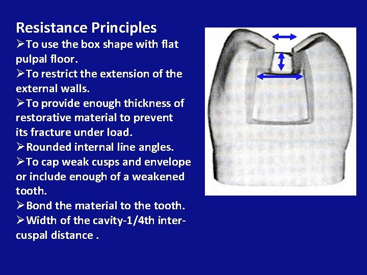 Resistance Principles ØTo use the box shape with flat pulpal floor. ØTo restrict the