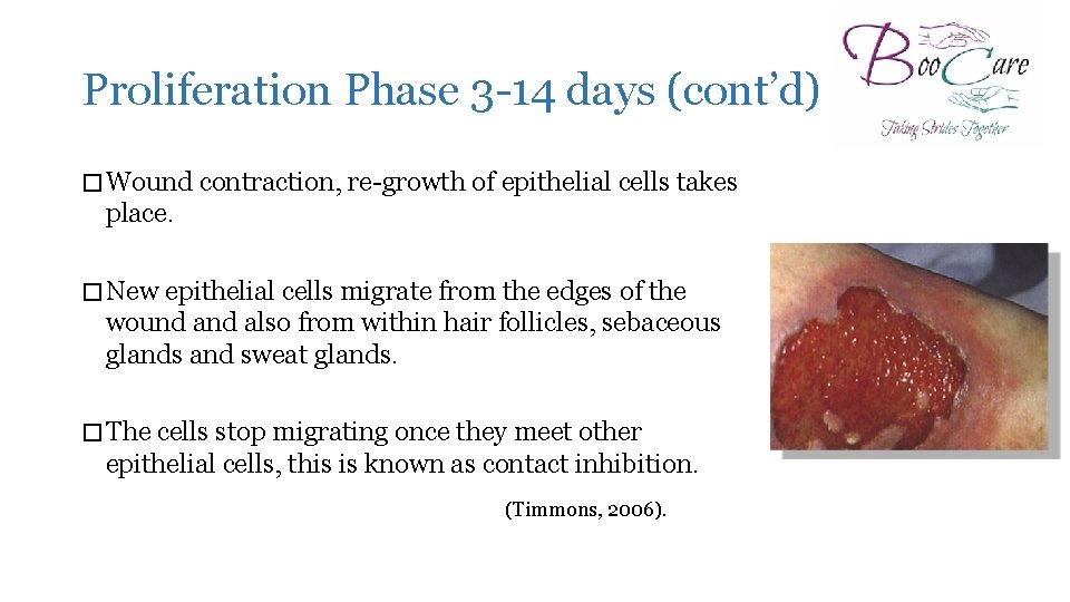 Proliferation Phase 3 -14 days (cont’d) � Wound contraction, re-growth of epithelial cells takes