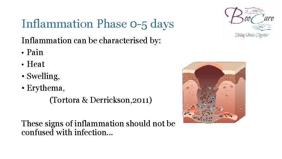 Inflammation Phase 0 -5 days Inflammation can be characterised by: • Pain • Heat