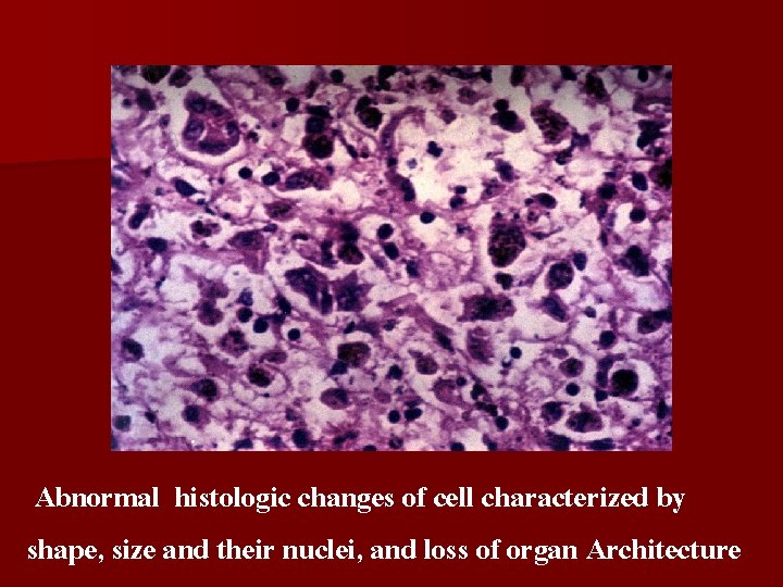 Abnormal histologic changes of cell characterized by shape, size and their nuclei, and loss